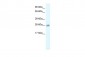 CLIC5 antibody - C-terminal region